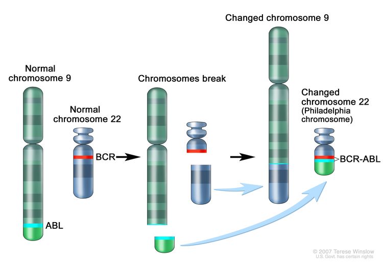 Philadelphia chromosome; three-panel drawing shows a piece of chromosome 9 and a piece of chromosome 22 breaking off and trading places, creating a changed chromosome 22 called the Philadelphia chromosome. In the left panel, the drawing shows a normal chromosome 9 with the ABL gene and a normal chromosome 22 with the BCR gene. In the center panel, the drawing shows chromosome 9 breaking apart in the ABL gene and chromosome 22 breaking apart below the BCR gene. In the right panel, the drawing shows chromosome 9 with the piece from chromosome 22 attached and chromosome 22 with the piece from chromosome 9 containing part of the ABL gene attached. The changed chromosome 22 with the BCR-ABL gene is called the Philadelphia chromosome.